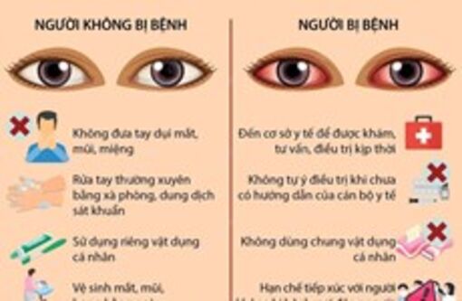 Cách phòng tránh lây lan của bệnh đau mắt đỏ