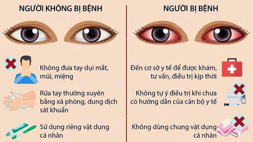 Sở Y tế An Giang chỉ đạo tăng cường phòng, chống và điều trị bệnh đau mắt đỏ