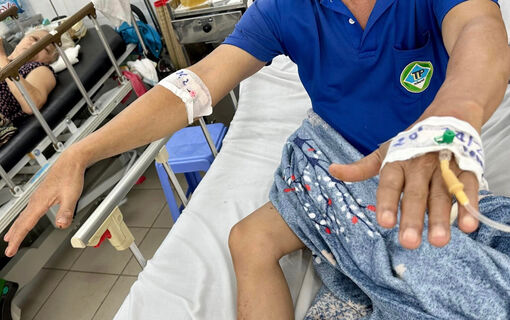 Hơn 300 ca đột quỵ dồn về một bệnh viện tại TP.HCM trong dịp Tết