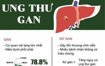 Nhìn vào mắt, phát hiện dấu hiệu ung thư gan