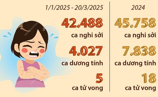 Cả nước ghi nhận gần 42.500 trường hợp nghi sởi