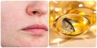5 dấu hiệu cho thấy cơ thể bạn đang thiếu Omega-3