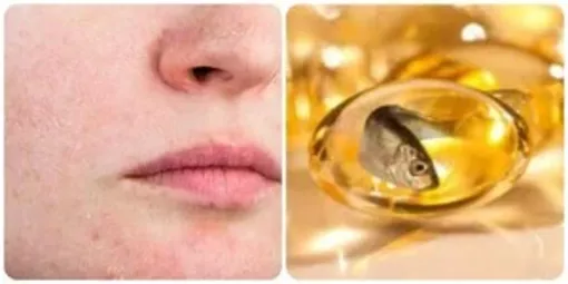 5 dấu hiệu cho thấy cơ thể bạn đang thiếu Omega-3