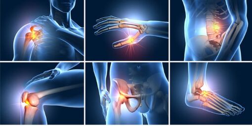 Thoái hóa khớp giai đoạn sớm: Nên bắt đầu bằng thuốc bôi tại chỗ và tập luyện