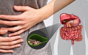 Bệnh sỏi mật và những biến chứng nguy hiểm không thể chủ quan