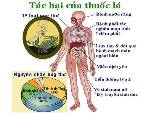 Hút thuốc lá có nguy cơ mắc ung thư cao Hút thuốc lá có nguy cơ mắc ung thư cao