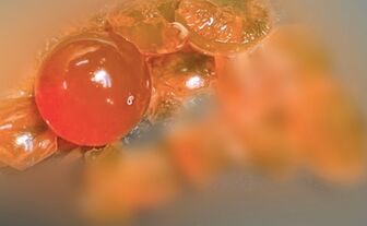 Bé trai 14 tháng tuổi phải nhập viện vì nuốt hạt nở đồ chơi