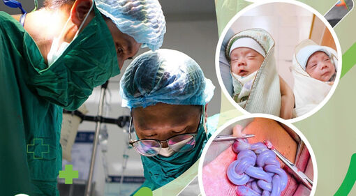 Giải cứu kịp thời cặp song sinh có dây rốn xoắn như "tết tóc" ở tuần thai 30