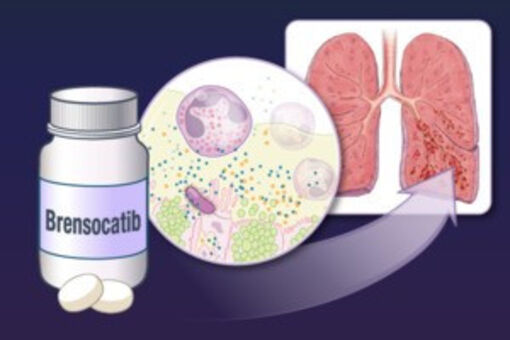 EU cấp phép thuốc mới điều trị bệnh phổi mạn tính nghiêm trọng