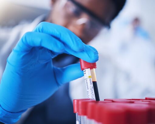 Xét nghiệm máu chích đầu ngón tay có thể phát hiện bệnh trước 10 năm