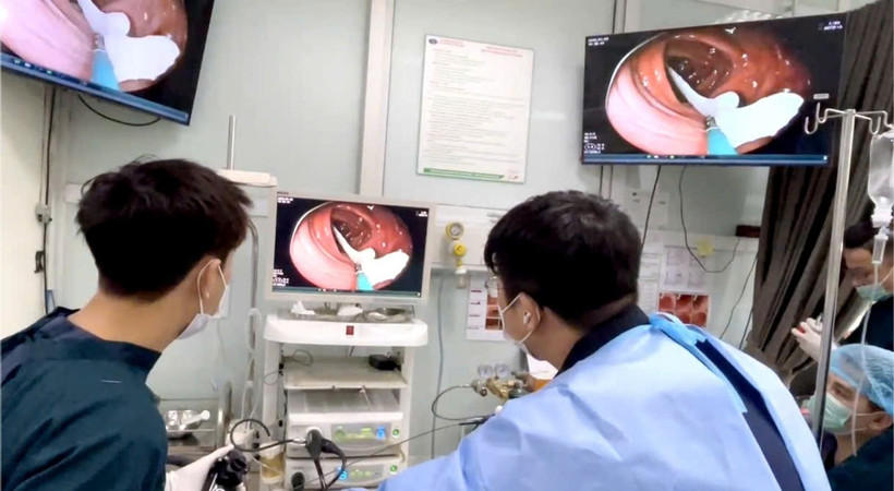 Gắp con sán dây dài gần 1 mét trong đại tràng người bệnh thích ăn đồ tái