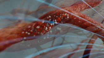 Robot siêu nhỏ giúp tan máu đông