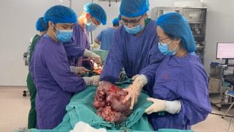 Chủ quan, người bệnh để khối u âm thầm phát triển chiếm gần hết ổ bụng