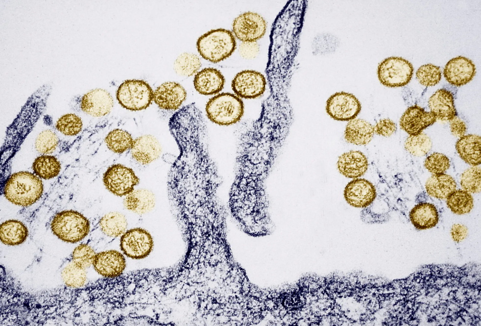 Bộ Y tế thông tin chính thức về bệnh do virus Hanta