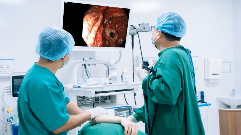 Bác sĩ cảnh báo xuất huyết tiêu hóa có thể diễn tiến âm thầm, ít triệu chứng