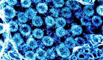 SARS-CoV-2 có thể kích hoạt virus tiềm ẩn, hé lộ cơ chế “long COVID”